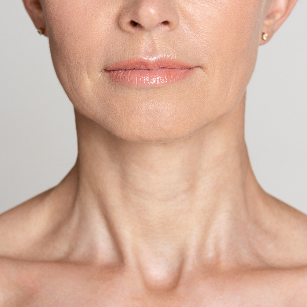 NeckFix: Nefertiti Lift – Beauty Fix MedSpa