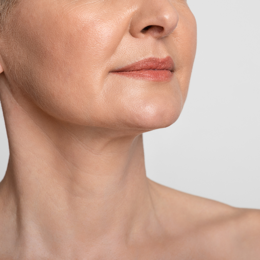 NeckFix: Nefertiti Lift – Beauty Fix MedSpa