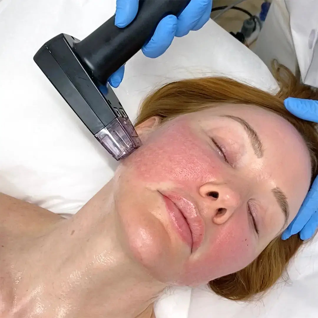 SkinFix: Morpheus8 | BeautyFix MedSpa - (212) 366-4787